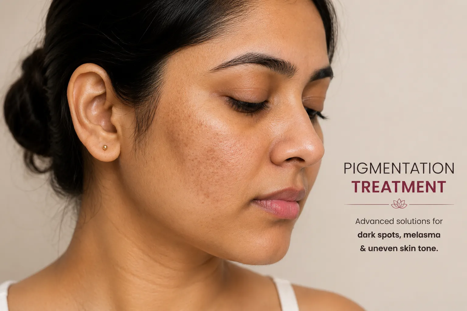 Pigmentation treatment session